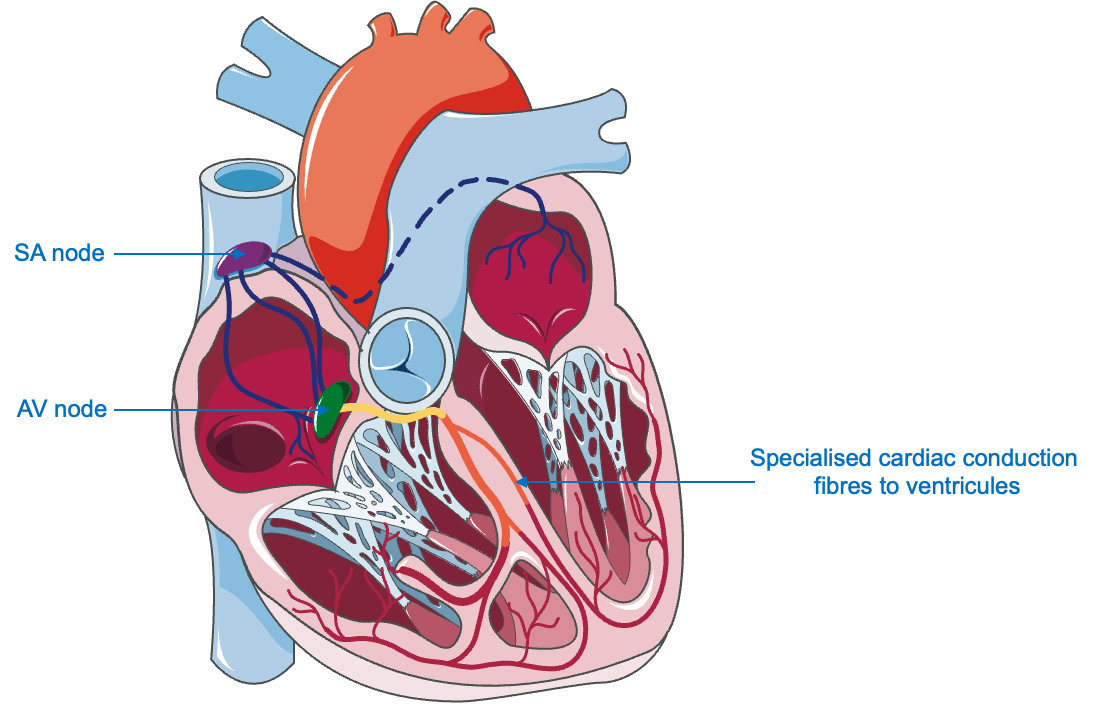 Pace And Ablate Part 1